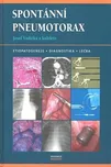 Spontánní pneumotorax - Josef Vodička