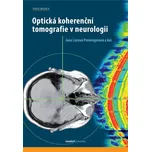 Optická koherenční tomografie v…