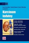 Karcinom ledviny - Ivan Kolombo