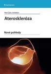 Ateroskleróza: Nové pohledy - Aleš Žák