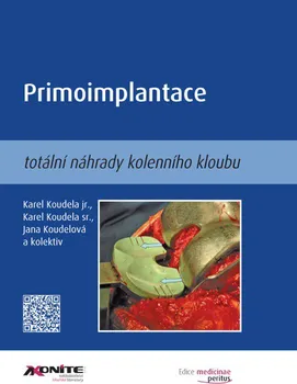Primoimplantace totální náhrady kolenního kloubu - Karel Koudela st., Karel Koudela jr., Jana Koudelová