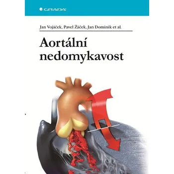 Aortální nedomykavost - Jan Vojáček, Pavel Žáček