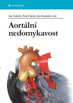 Aortální nedomykavost - Jan Vojáček, Pavel Žáček