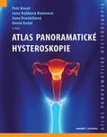 Atlas panoramatické hysteroskopie -…