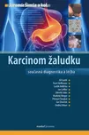 Karcinom žaludku - Jaromír Šimša