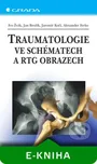 Traumatologie ve schématech a RTG…