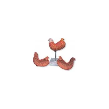 Žaludek - 2 části