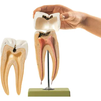 Stolička se zubním kazem