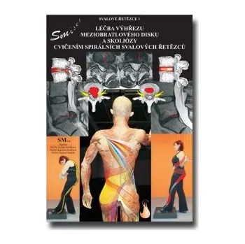 Spirální stabilizace páteře - kniha Léčba výhřezu meziobratlového disku bez operace