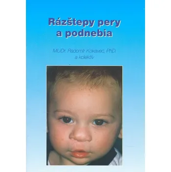 Rázštepy pery a podnebia - Radomír Kokavec
