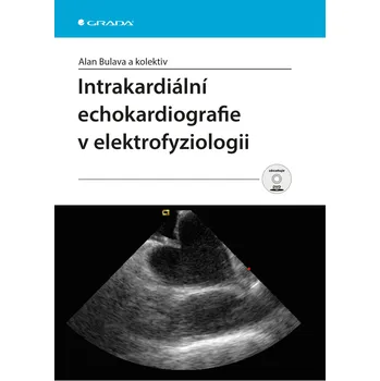 Intrakardiální echokardiografie v elektrofyziologii - Alan Bulava a kolektiv
