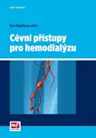 Cévní přístupy pro hemodialýzu - Eva…