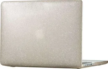 pouzdro na notebook Speck Smartshell Glitter Pro 13" (90207-5636)