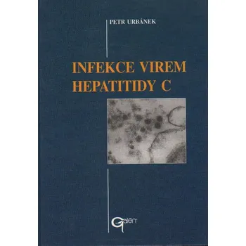 Infekce virem hepatitidy C - Petr Urbánek