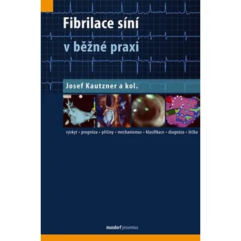 Fibrilace síní v běžné praxi - Josef Kautzner