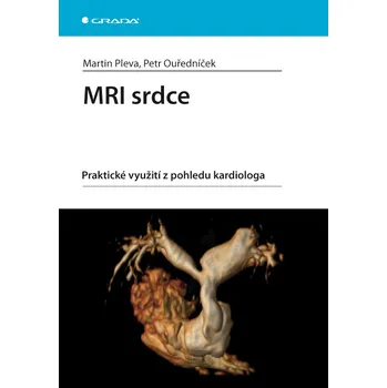 MRI srdce - Petr Ouředníček, Martin Pleva (E-Kniha)