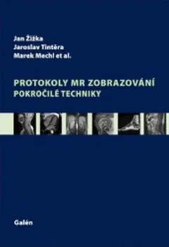 učebnice Protokoly MR zobrazování: Pokročilé techniky - Jan Žižka a kol.