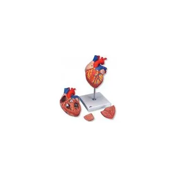 Model srdce velký - 4 části