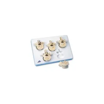 Sada pěti bederních obratlů