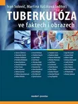 Tuberkulóza ve faktech i obrazech -…