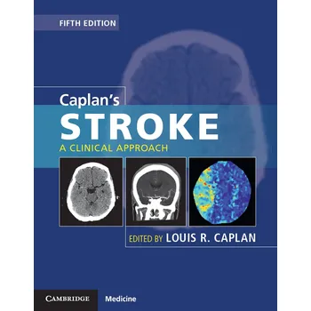 Caplan's Stroke: A Clinical Approach -…