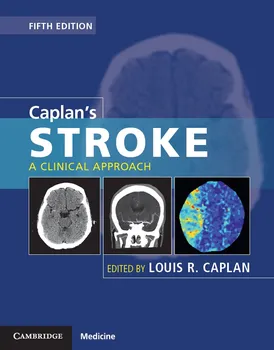 Caplan's Stroke: A Clinical Approach - Louis R. Caplan [EN] (2016, pevná, 5th Edition)