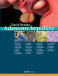 Adenomy hypofýzy - David Netuka (2019,…