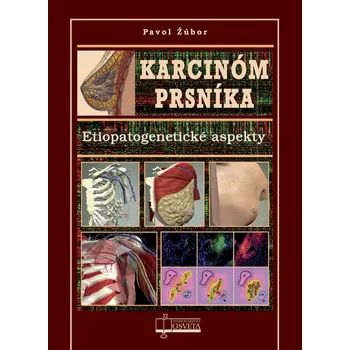 Karcinóm prsníka - Pavol Žúbor