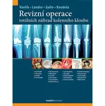 Revizní operace totálních náhrad…