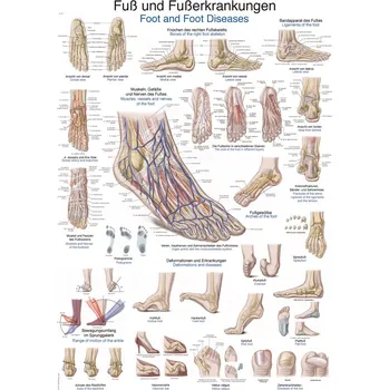 Plakát - onemocnění nohou a chodidel 70x100 cm