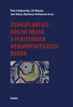 Transplantace kostní dřeně a…