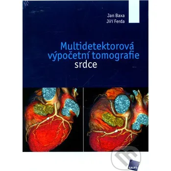 Multidetektorová výpočetní tomografie srdce -  Jan Baxa, Jiří Ferda 