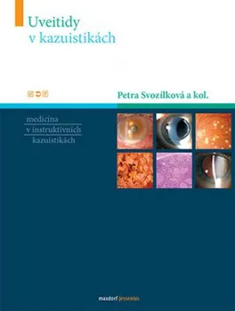 Uveitidy v kazuistikách - Petra Svozílková a kolektiv