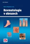 Revmatologie v obrazech - Marta…