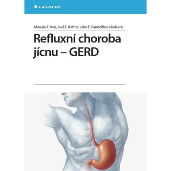 Refluxní choroba jícnu: GERD - Marcelo…