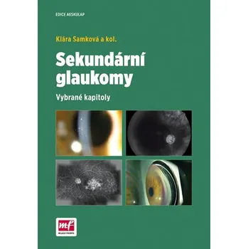 Sekundární glaukomy - Klára Samková