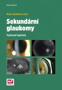 Sekundární glaukomy - Klára Samková