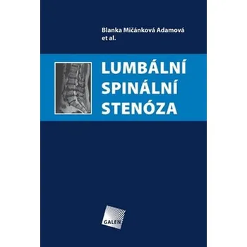 Lumbální spinální stenóza - Blanka Mičánková Adamová a kol.