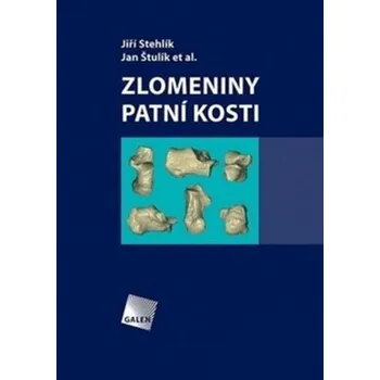 Zlomeniny patní kosti - Jiří Stehlík, Jan Štulík