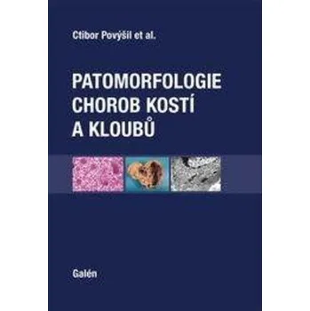 Patomorfologie chorob kostí a kloubů - Ctibor Povýšil