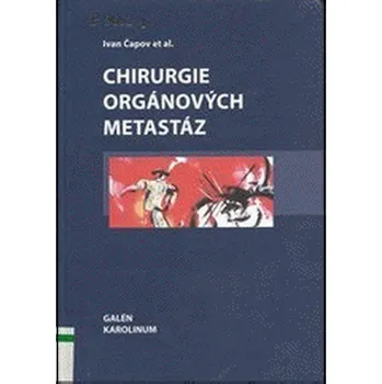 Chirurgie orgánových metastáz - Ivan…