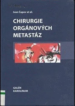 Chirurgie orgánových metastáz - Ivan Čapov a kol.