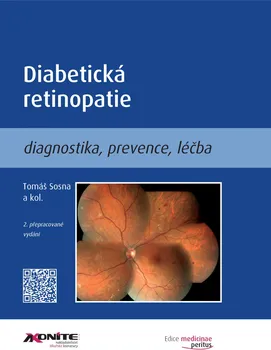Diabetická retinopatie: Diagnostika, prevence, léčba - Tomáš Sosna