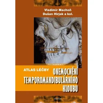 Atlas léčby onemocnění temporomandibulárního kloubu - Vladimír Machoň Atlas léčby onemocnění temporomandibulárního kloubu - Vladimír Machoň