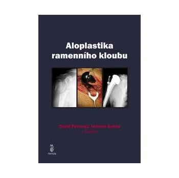Aloplastika ramenního kloubu - Antonín Sosna, David Pokorný