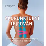 Akupunkturní tejpování: Účinné při…