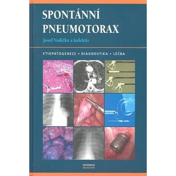 Spontánní pneumotorax - Josef Vodička