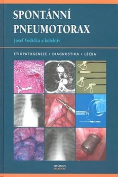 Spontánní pneumotorax - Josef Vodička