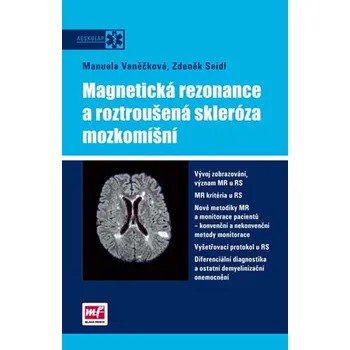 Magnetická rezonance a roztroušená skleróza mozkomíšní - Manuela Vaněčková