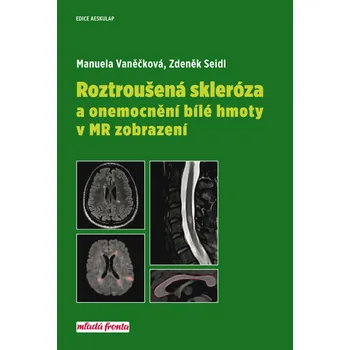 Recenze Roztroušená skleróza a onemocnění bílé hmoty v MR zobrazení - Zdeněk Seidl, Manuela Vaněčková (2018, pevná bez přebalu lesklá)